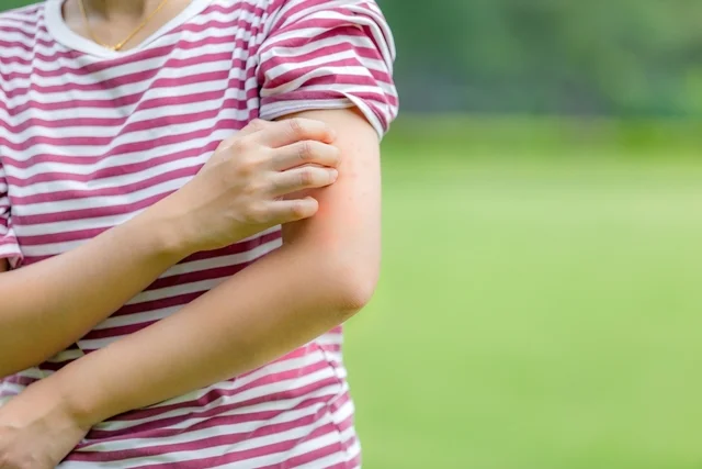 por que alergia coça